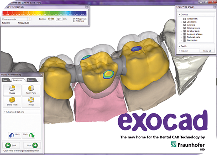 dental cad cam software free download